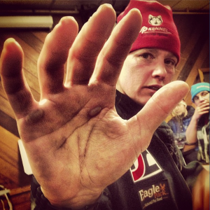 Aliy Zirkle's hand is covered in is terms from using her ski pole so much on the Iditarod trail. Photo by Emily Schwing, KUAC - Fairbanks.