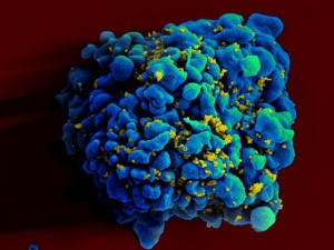 HIV infected H9 T cell; from WikiCommons
