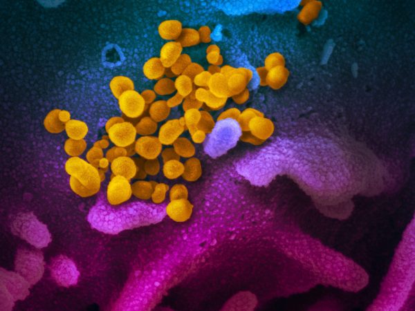 A microscopic image of yellow blobs in a purple background